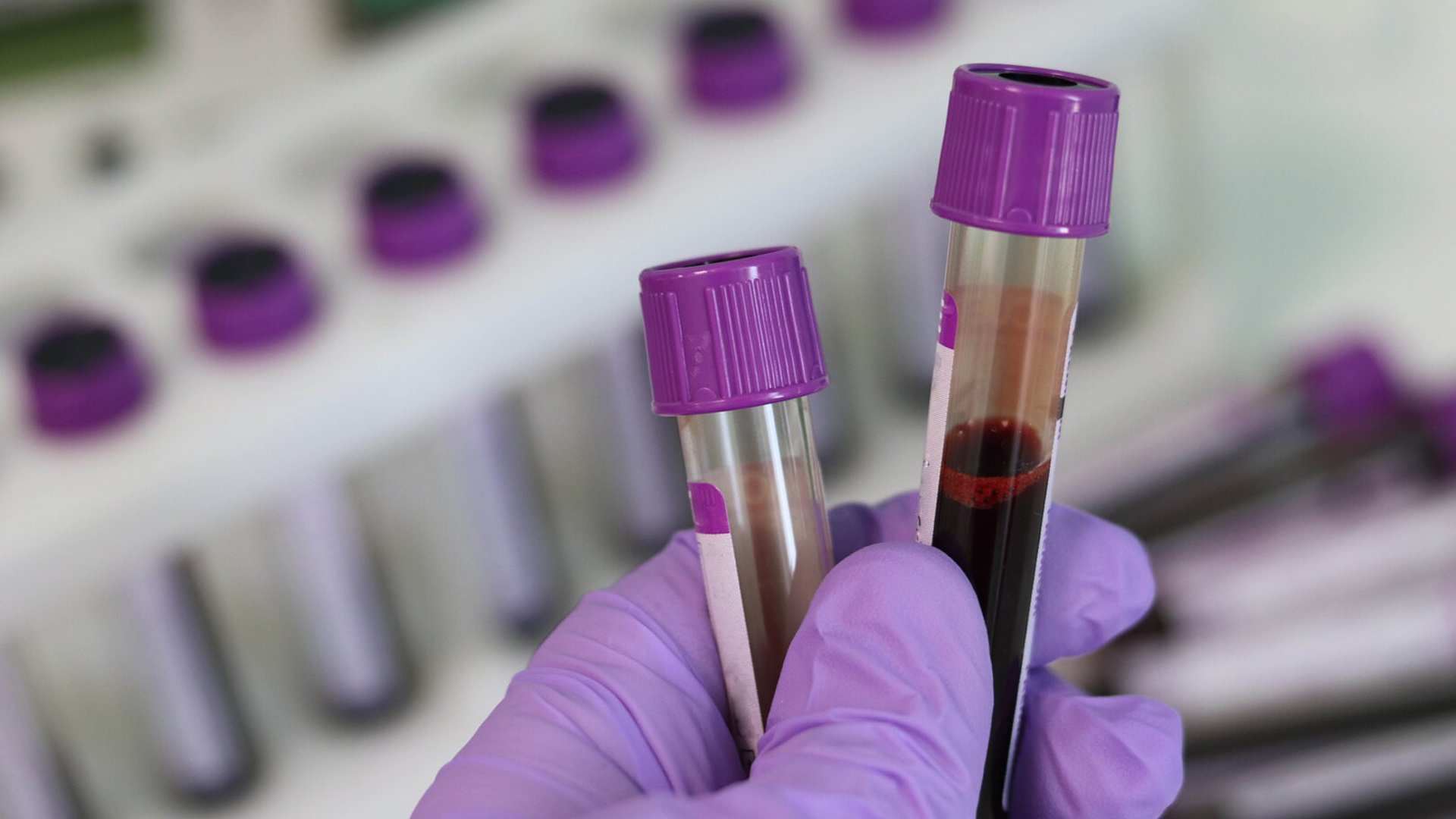 Biochemistry Solutions